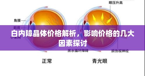 白内障晶体价格解析，影响价格的几大因素探讨