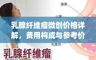 乳腺纤维瘤微创价格详解，费用构成与参考价位一网打尽